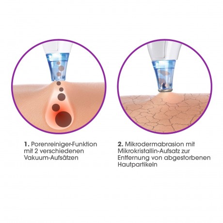 MAXXMEE Vitalmaxx Porenreiniger 5-tlg. 3,7V mit Aufsatz fur Mikrodermabrasion  Очиститель пор Vitalmaxx 5 шт. 3,7 В с насадкой для микродермабразии