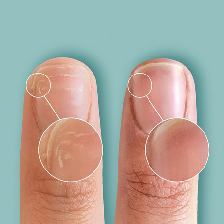 CND CND™ Nagelkur  Уход за ногтями CND™