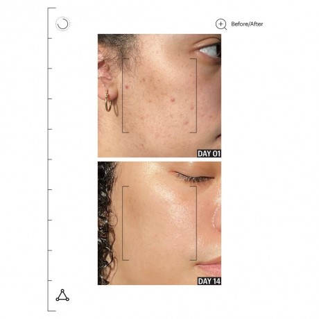 Allies of Skin Molecular Barrier Recovery Cream Balm  Крем-бальзам для восстановления молекулярного барьера