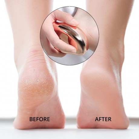 Ailoria Fuss Hornhautentferner Средство для удаления мозолей на ногах