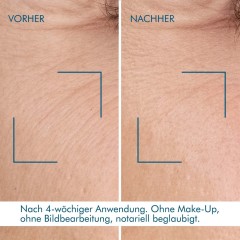 Biotherm Blue Retinol Resurface + Repair Night Serum  Blue Retinol Resurface + Восстанавливающая ночная сыворотка