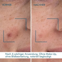 Biotherm Blue Retinol Resurface + Repair Night Serum  Blue Retinol Resurface + Восстанавливающая ночная сыворотка