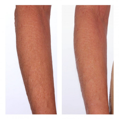 U BEAUTY The Sculpt Arm Compound  Состав для скульптурной руки