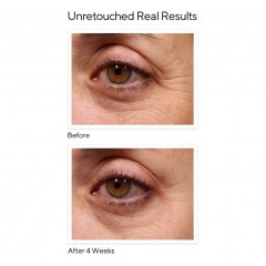 MURAD Retinol Youth Renewal Eye Serum  Обновляющая сыворотка для кожи вокруг глаз с ретинолом