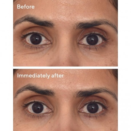 MURAD Retinol Youth Renewal Eye Masks  Ретиноловые омолаживающие маски для глаз