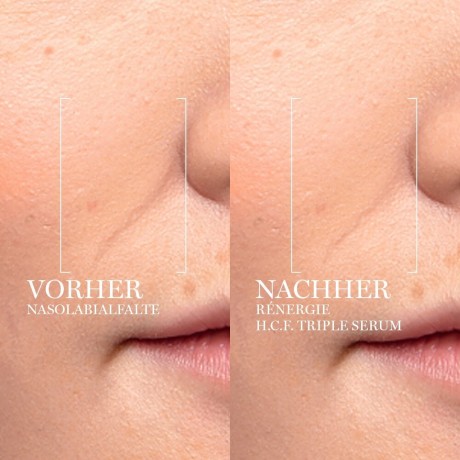 Lancome Renergie H.C.F. Triple Serum Тройная сыворотка антивозрастная 50мл