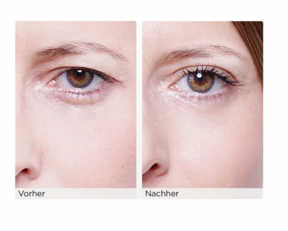 Wonderstripes S, 64 Stripes, Полоски для подтяжки век, 64шт