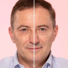 Wunder2 WUNDERLIFT 12 ml ЧУДО-ЛИФТ