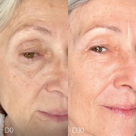 Caudalie Anti-Pigmentflecken Glykol-Nachtcreme  Гликолевый ночной крем против пигментации