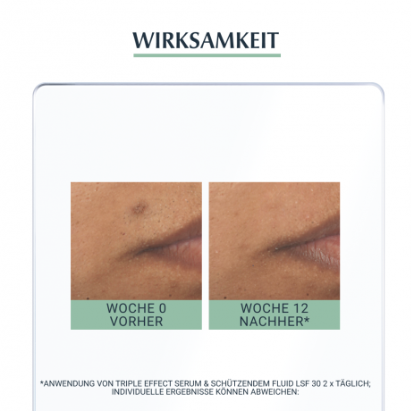 Eucerin DermoPure Triple Effect Serum  DermoPure Сыворотка с тройным эффектом