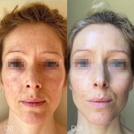 Caudalie Serum  сыворотка