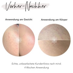 FACES OF FEY Dermaroller 0,5mm  Ролик для кожи 0,5 мм